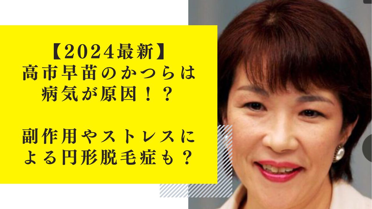 【2024最新】高市早苗のかつらは病気が原因！？副作用やストレスによる円形脱毛症も？